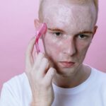 13 Acne Skincare Routine That Actually Work